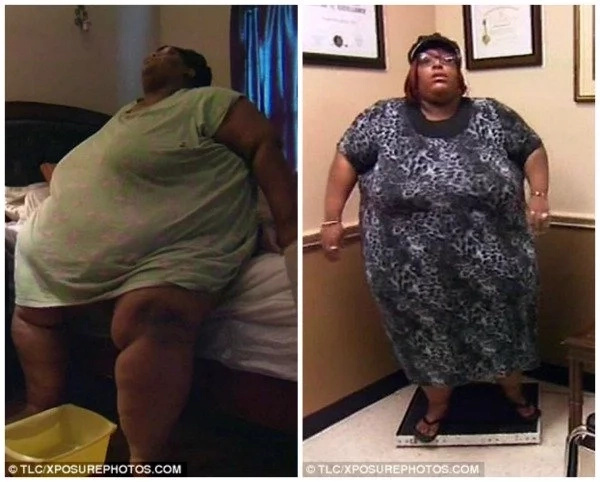 Determined woman weighing 272kg sheds 53kg after her mom died of extreme OBESITY (photos) Determined woman weighing 272kg sheds 53kg after her mom died of extreme OBESITY (photos)
