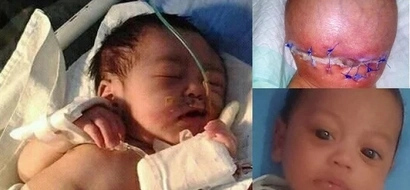 Nakakaawa! Father forced to beg for 4-month-old baby ravaged by flesh-eating bacteria