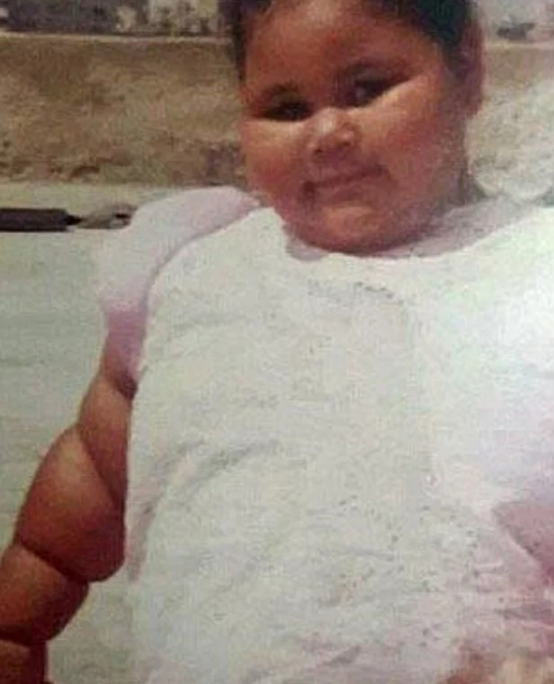 World's fattest woman reaches 495 KILOS and now needs life-saving surgery (photos)
