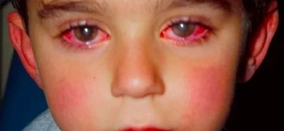 Boy Lost 75% of His Eyesight After Playing With THIS Common Toy!