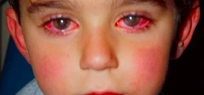 Boy Lost 75% of His Eyesight After Playing With THIS Common Toy!