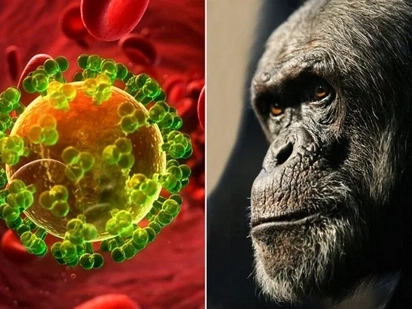 Scientists Have Tracked Down The First Human Aids Victim