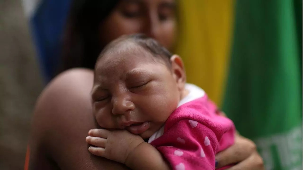zika-baby zika-baby