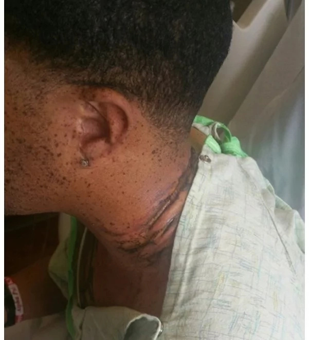Man falls asleep with iPhone charging in bed, it electrocutes him almost to death (photos, video) Man falls asleep with iPhone charging in bed, it electrocutes him almost to death (photos, video)