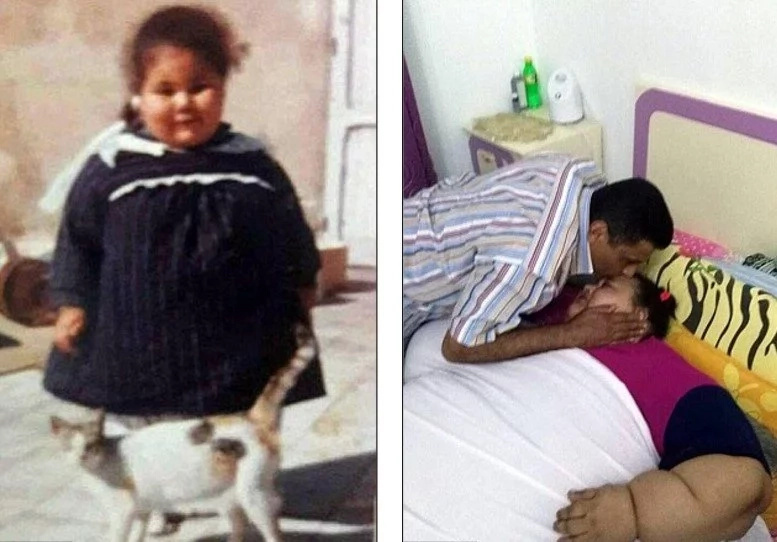 World's fattest woman reaches 495 KILOS and now needs life-saving surgery (photos)