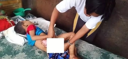 Netizens cry out for help for this young boy suffering from 3rd degree burns