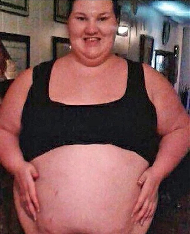 Woman who weighed 188 kg sheds HALF her weight but has to live with bags of floppy skin (photos)