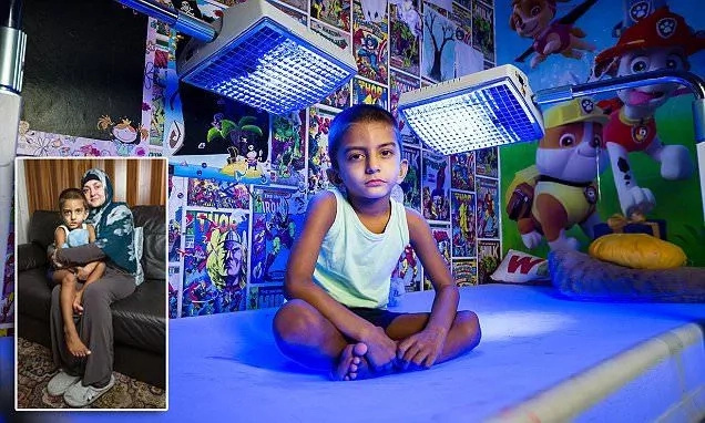 4-year-old boy spends 20 hours each day under blue lights to keep him alive (photos) 4-year-old boy spends 20 hours each day under blue lights to keep him alive (photos)