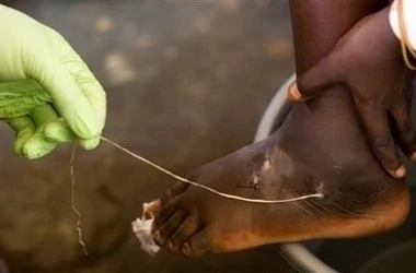 Unimaginable things that can be found inside the human body Unimaginable things that can be found inside the human body