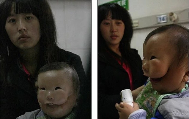 Story of boy born with 2 faces will break your heart (photos, video)