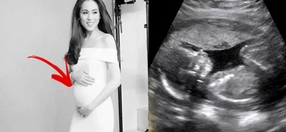 LOOK: Toni and Paul reveal baby’s gender
