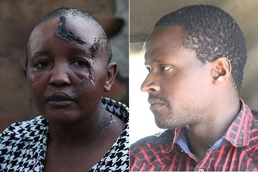 Kenyan woman's hands chopped off because she cannot have kids