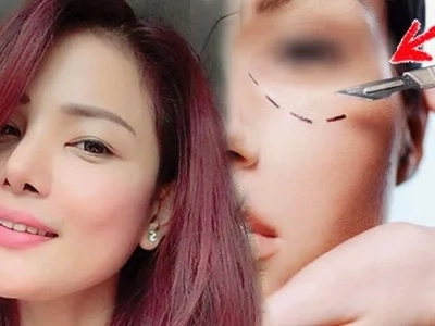 4 hidden DANGERS of plastic surgery that will scare you to go under the knife