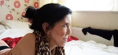 Girl, who is 16 but looks like 60, given free face-lift by kindhearted surgeon
