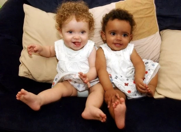 The twins when they were one year old. Photo: SWNS