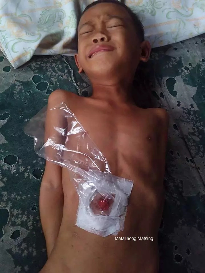Netizens concerned with poor boy's condition Netizens concerned with poor boy's condition