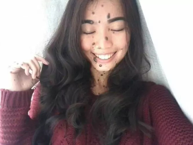 She was bullied because of her moles. She redefines beauty by joining Miss Universe Malaysia She was bullied because of her moles. She redefines beauty by joining Miss Universe Malaysia