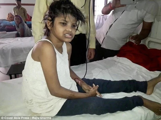 Girl found living with monkeys walks upright for the first time (photos, video) Girl found living with monkeys walks upright for the first time (photos, video)
