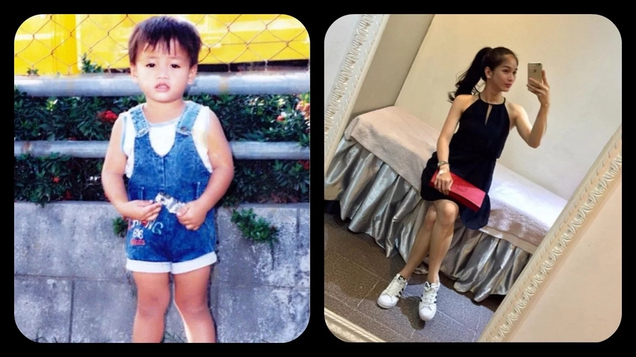 6 Remarkable Pinoy transgender before and after surgery 6 Remarkable Pinoy transgender before and after surgery