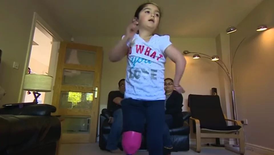 7-year-old disabled girl shows off her new leg for the first time 7-year-old disabled girl shows off her new leg for the first time
