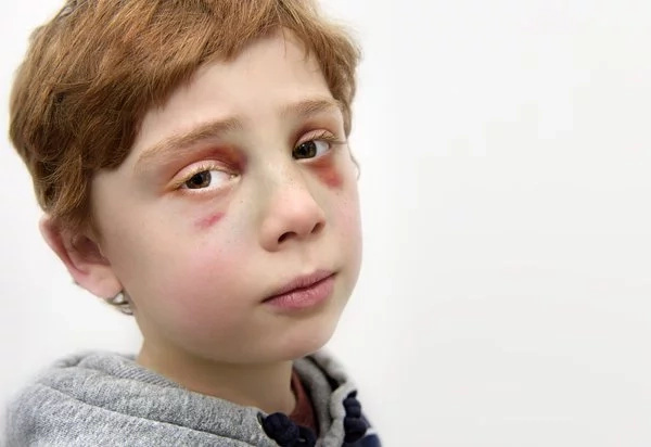 Boy dies after his parents hit him several times Boy dies after his parents hit him several times