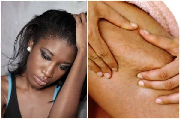 Ladies beware, these 6 INNOCENT foods could be the reason you are losing your shape