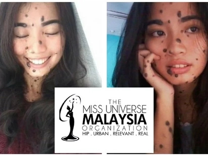 She was bullied because of her moles. She redefines beauty by joining Miss Universe Malaysia!