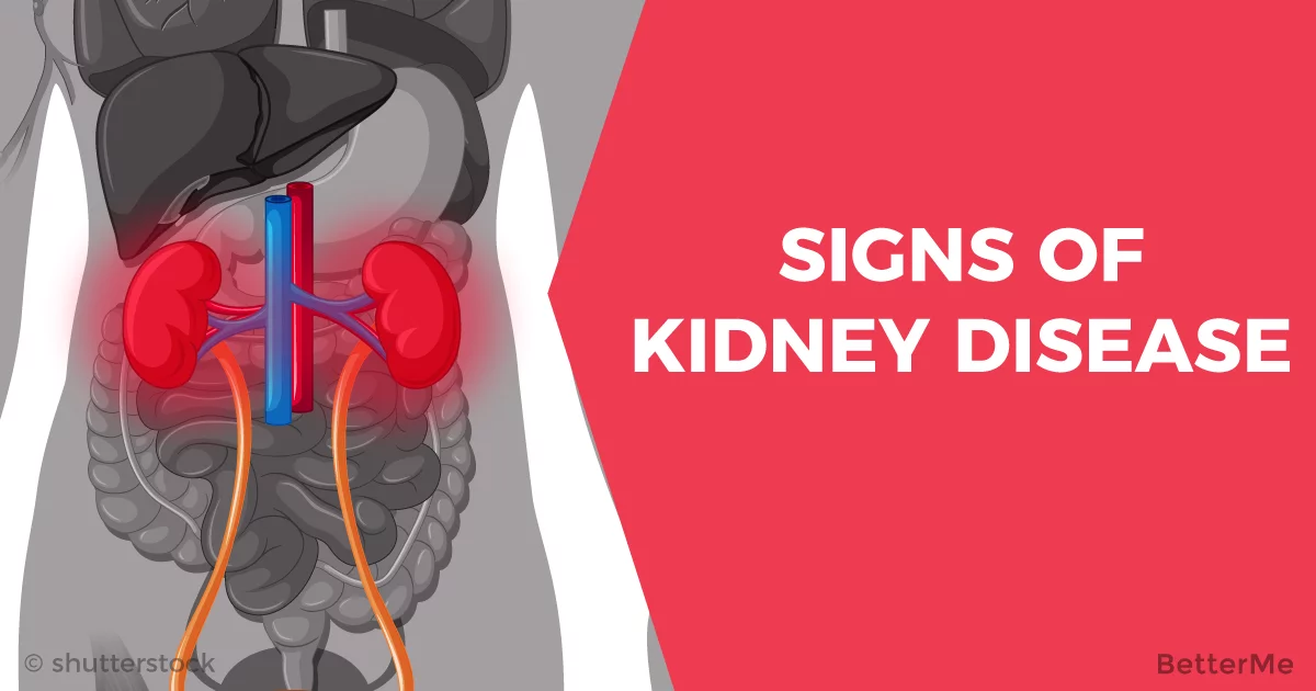 10 Kidney Disease Symptoms You Shouldnt Ignore