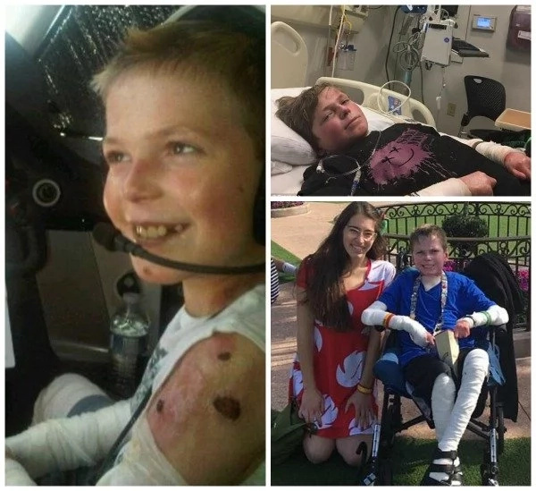 See boy, 14, whose parents can't hug him because it will RIP OFF his skin (photos, video) See boy, 14, whose parents can't hug him because it will RIP OFF his skin (photos, video)