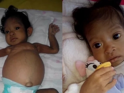 Sick baby Athena needs your help for her liver transplant