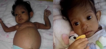 Sick baby Athena needs your help for her liver transplant