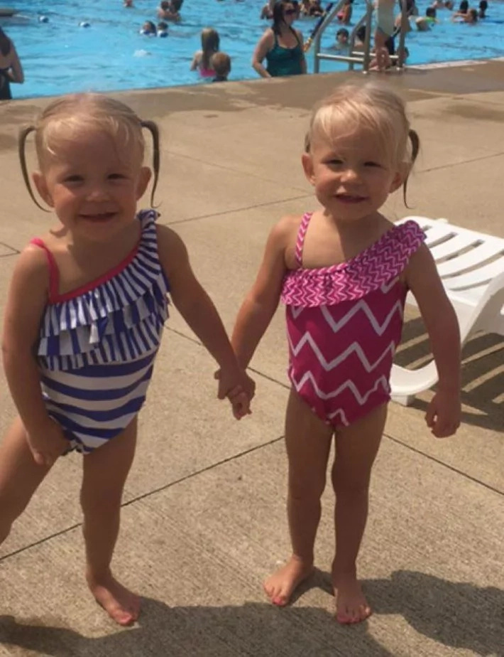 These twins were born holding hands and they are 2 years old! These twins were born holding hands and they are 2 years old!