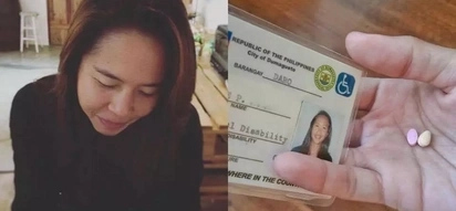 Tunay na palaban! Mentally ill netizen speaks frankly about her disability and she is not ashame