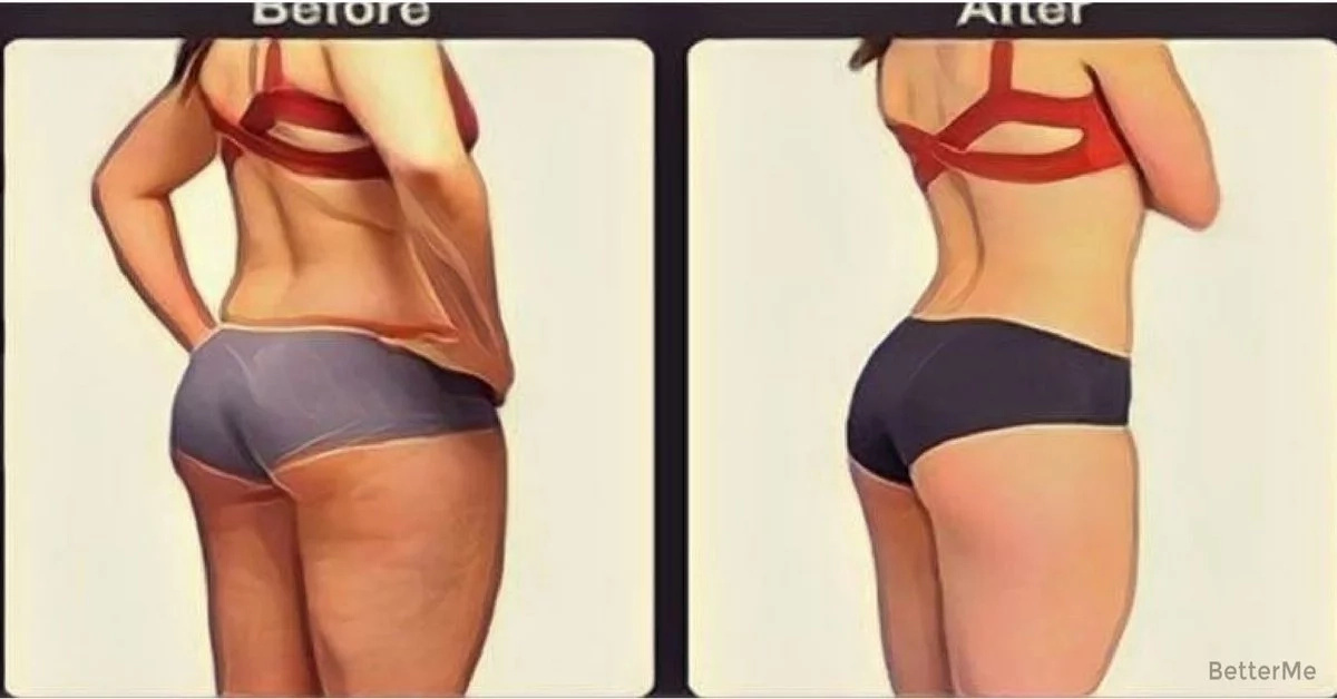 does brazilian butt lift workout get you in shape?