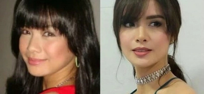 Erich Gonzales insists she did not have a nose job after a fan noticed it in her before and after photos