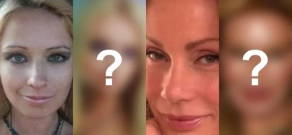 Before Shiryl Saturnino’s unfortunate incident, these 7 women had their share of failed plastic surgeries