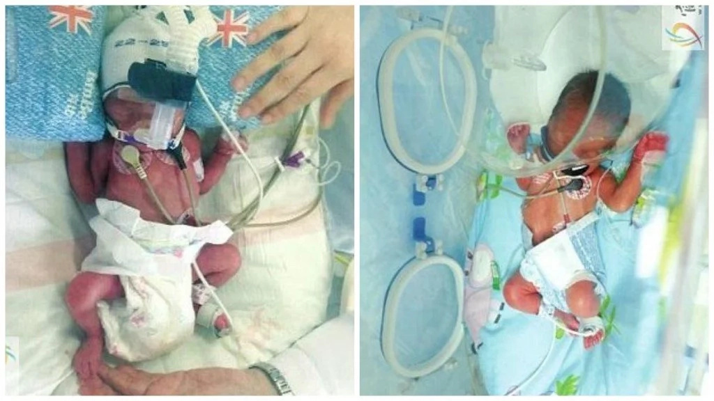 Woman who was barren gives birth TWICE in ONE WEEK, and they are triplets (photos)