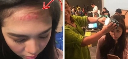 Janella Salvador naaksidente sa shooting. Elmo Magalona alalang alala!