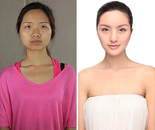 These women tried plastic surgery. The result? Shocking! These women tried plastic surgery. The result? Shocking!