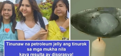 Pag mura dapat magduda! Three friends regret P500 'bagsak-presyo' facial injections which led to their hideous transformations