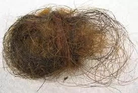 Witchcraft? Zambia Mother Of Two Delivers Hair After Ten Months Of Pregnancy