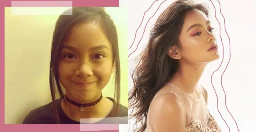 Gandang di mo inakala!Awkward pinoy childstars who became gorgeous Gandang di mo inakala!Awkward pinoy childstars who became gorgeous