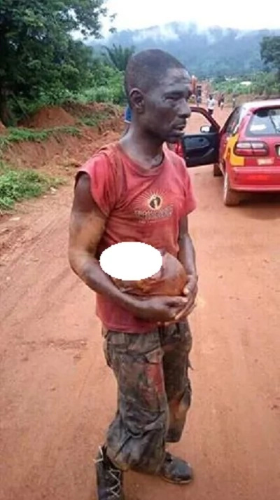 Man caught with a human head, was delivering it to a witchdoctor