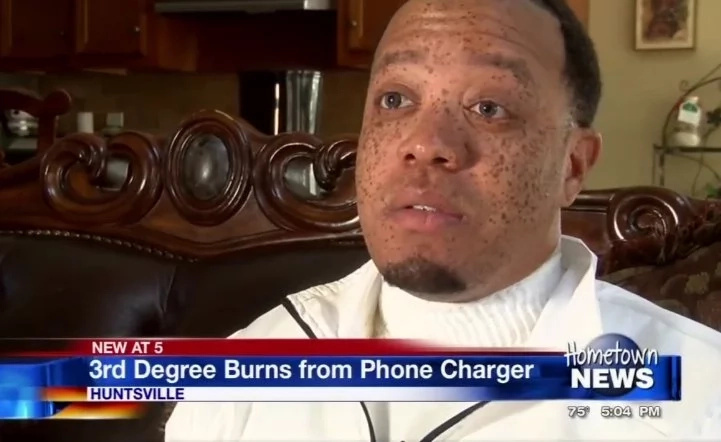 Man falls asleep with iPhone charging in bed, it electrocutes him almost to death (photos, video) Man falls asleep with iPhone charging in bed, it electrocutes him almost to death (photos, video)