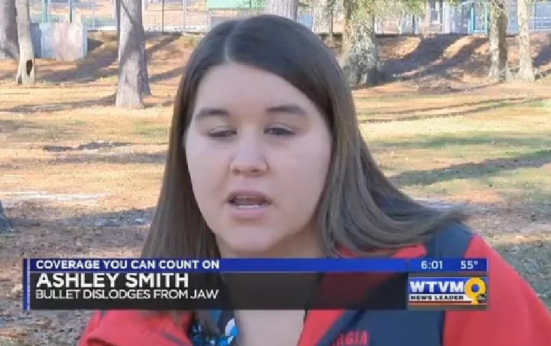 Woman felt a small lump protruding from her mouth. But when she tried to pull it out, it turned out to be a stray bullet! Woman felt a small lump protruding from her mouth. But when she tried to pull it out, it turned out to be a stray bullet!