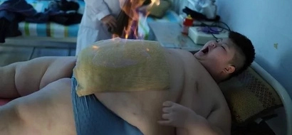 Would you set yourself on fire just to lose weight? This dangerously obese boy did