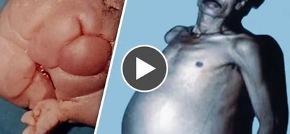 WATCH: Things you can never imagine to exist inside the human body!