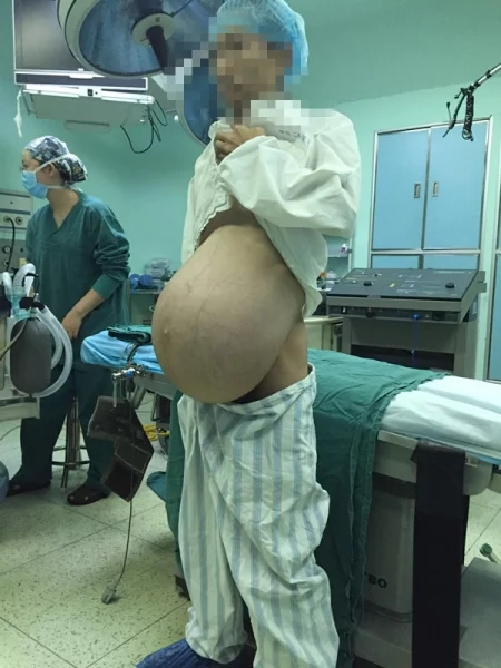 Another 'Pregnant Man' gives birth Another 'Pregnant Man' gives birth