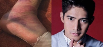 Netizens were shocked of what Robi Domingo posted on Instgram!