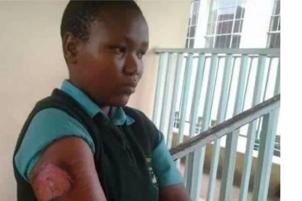 Injured Nyabururu Girls student.